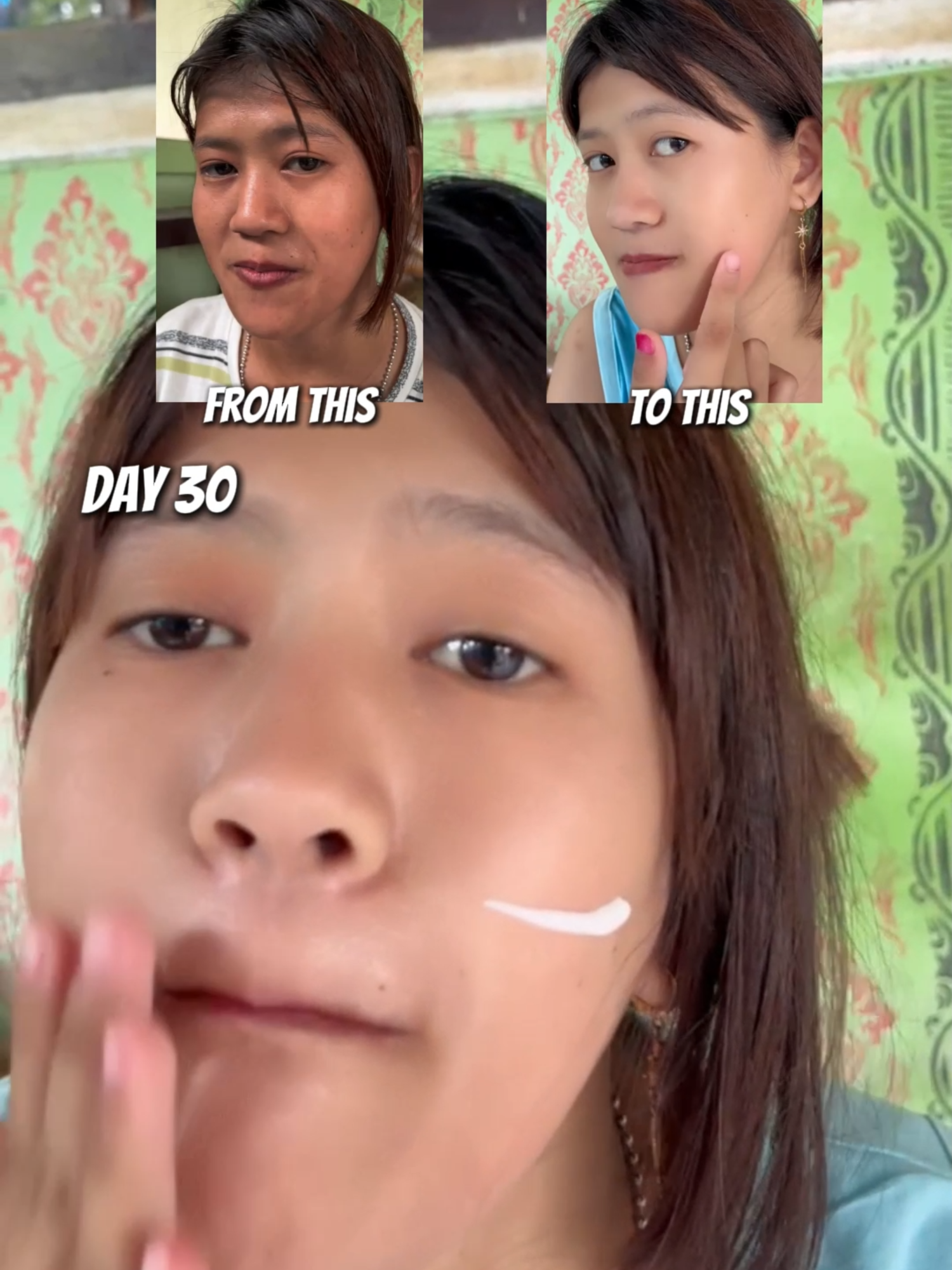 sebulan pemakaian cream viral chalonese wajah jadi glowing😮#brighteningcream #rekomendasiskincare #rekomendasicream #fyppppppppppppppppppppppp #bpomdanhalal✅ #bumilbusuiaman🥰 #skincareroutine #foryourbeauty #masukberanda #hydratedskin #chalonese #skincareviral #kulitkusam #brightening #viral