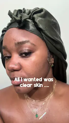 How to get clear skin NATURALLY 💅🏾💕 #naturalremedies #bodaciousbodybeads #turmericsoap #darkspots 