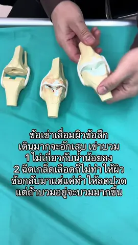 ข้อเข่าเสื่อมผิวข้อสึก เดินมากจะอักเสบ เข่าบวม 1 ไม่เกี่ยวกับนำ้น้อยลง 2 ฉีดเกล็ดเลือดก็ไม่ทำให้ผิวข้อกลับมาแต่แค่ทำให้ลดปวดแต่ถ้าบวมอยู่จะบวมมากขึ้น #ข้อเข่าเสื่อม #ผิวข้อสึก #นำ้ไม่น้อย #ด็อกเตอร์หมอหมี