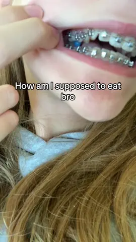 I can’t with these braces #braces #sad #funny #viral #fyp 