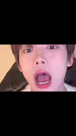 Ziyu teeth 🦷 🥹.     #ziyu_梓渝 #ziyu #douyin抖音 #tianzi 