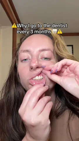 Replying to @Wsveenuh PLEASE listen to this🙏 take care of your oral health! #periodontaldisease #gingivitis #gumdisease #dentalcare #floss @MEETCOCOLAB 
