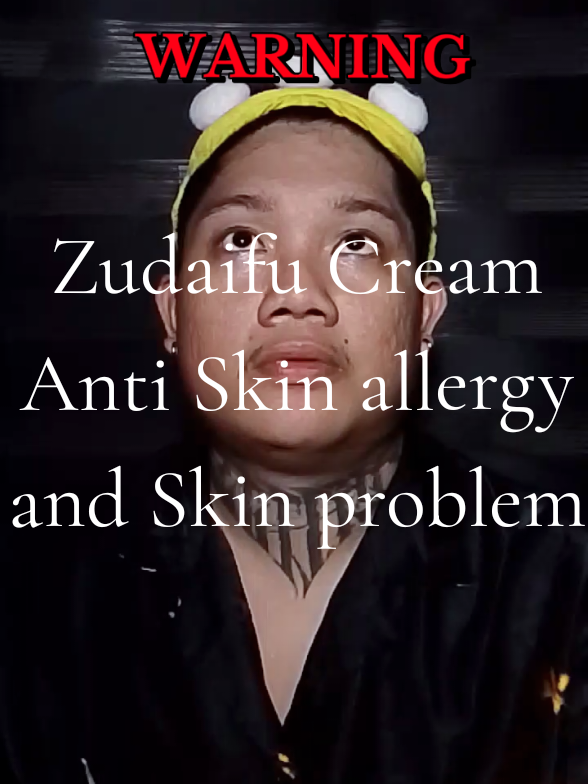 Skin rescue cream na legit — pampawala kati, peklat at pimples. Mura lang ngayon, bilis! #BudolTropa #SkinCarePH #MiaoJiaDoctorZu #AddToCartNa