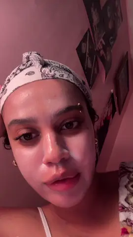 Ignore the diaper rash cream on my face