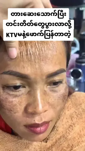 #တစ်ထုတ်၅၅၀၀#အိမ်ရောက်ငွေချေနဲ့ပို့ပေးပါတယ် #တင်းတိတ်အမဲစက်အတွက် #foryou #မြင်ပါများပီးချစ်ကျွမ်းဝင်အောင်လို့🤒🖤 @အာမခံတင်းတိတ်ပျောက်ဆေး🥑 @အာမခံတင်းတိတ်ပျောက်ဆေး🥑 @အာမခံတင်းတိတ်ပျောက်ဆေး🥑 