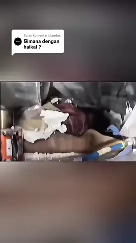 yusuf duluan sudah di evakuasi ya ka ..ni skrg haikal yg sebelahan sm yusuf ,smua selamat ya tmn2 . ijin ambil ulang video nya ka . source : pedot