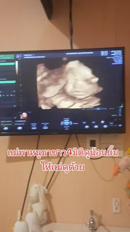 #ลูกชายสุดที่รัก #ทีม2มกราคม2569 #บันทึกลูกรัก