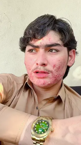 Wakhai 💔😭🥹#dcwazir #growmyaccount✅♥️♥️♥️ #plzzduetme #unfreezemyaccountplz🙏🙏 @🇦🇫𝙍𝙚𝙢𝙞𝙭_𝙆𝙞𝙣𝙂🇦🇫 @آنگــــار آشنـــاه 