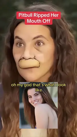 #news #fyp #breakingnews