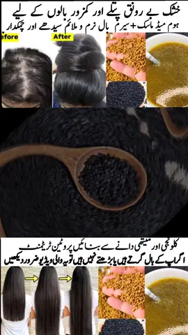 hair fall solution #tik_tok #foryoupage❤️❤️ #forypupage #remedy #hairfallsolution 