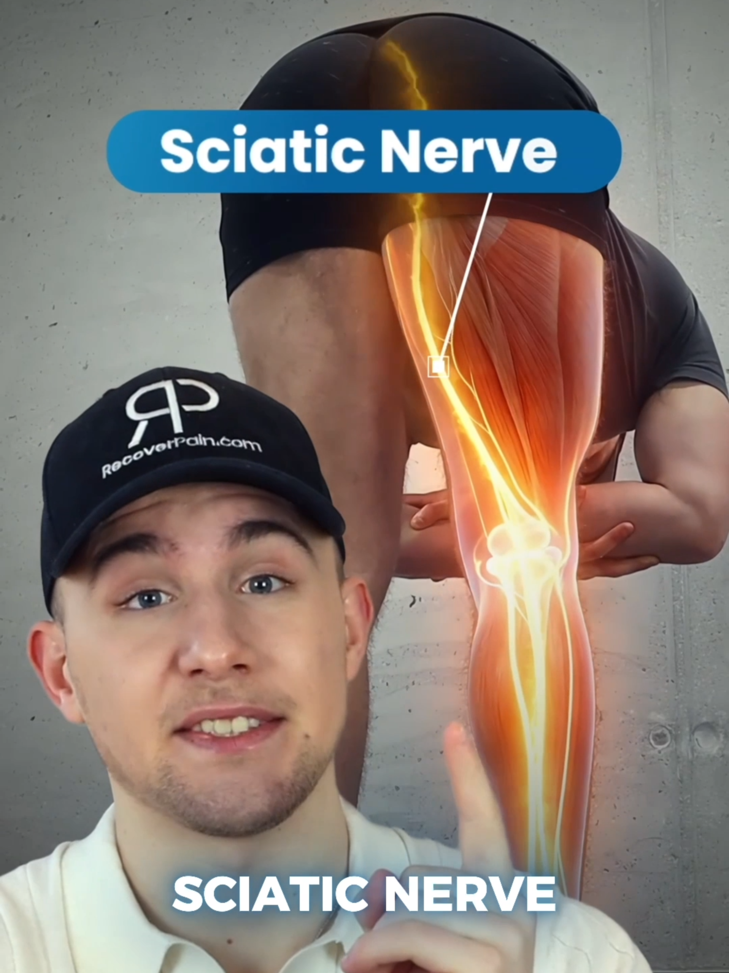 💥 What Is Sciatica? #sciatica