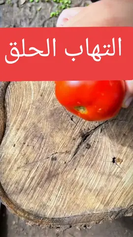 التهاب الحلق، طبخ الطماطم والعسل والليمون 3 ملاعق صباحا ومساءا #creatorinsights #creator #tiktoktips #creatorrevolution #hashtags 
