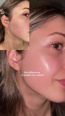 Who said aging backwards is impossible? Skincare from @numbuzin_global 💜  #numbuzin #no9essence #no9glowtoner #nad #glowingskin