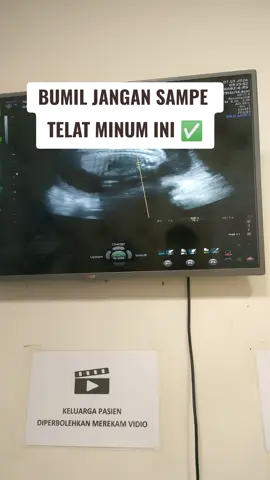 susu bumil yang rendah gula tinggi asam folat dan kaya nutrisi #xybca #almonde #yummysmomnbabe 