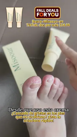 Esto no es solo una crema. Es confianza en un tubo. @Misoour#misoour#tiktokshopfalldealsforyou #dryskin #footcare #urea