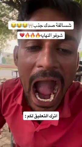 ماكو هيج بشر🔥😂😂😂🦷 —— #اكسبلورexplore #طب_اسنان #جامعة_التراث #جامعة_بغداد #العراق_السعوديه_الاردن_الخليج 