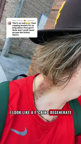 Replying to @Anna J🌻 🤦🏼‍♂️🤦🏼‍♂️🤦🏼‍♂️