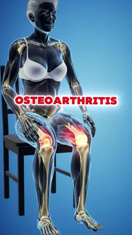 five dangerous signs of knee osteoarthritis #knee #osteoarthritis #kneepain #healthtip #usa_tiktok 