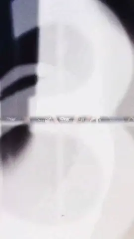 Recap Moment Salakbrojo Cup 2 #infotarkampekalongan #sepakbola #fyp #salakbrojocup #xyzbcafypシ 