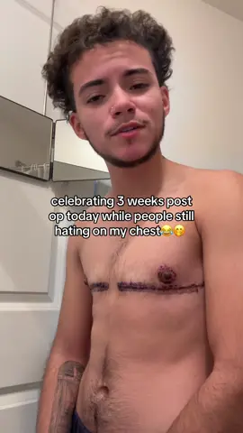 1 more week til i can raise my arms above my shoulders and mollywhop you hatin a$$ h0es🧌👹 #ftmmateo #fyp #lgbTq #topsurgery #transman 