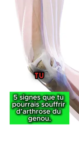 Voici 5 signes que tu as peut être de l’arthrose au genou ! 😳 #arthrose #france #sante #bienetre #fr 
