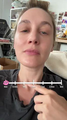 no lip filler for me