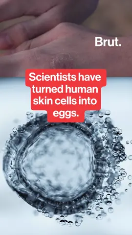 Scientists at Oregon Health & Science University, led by Professor Shoukhrat Mitalipov, have created human eggs from skin cells in a major fertility research breakthrough. The technique could one day help women facing infertility, though it remains in early experimental stages. #FertilityResearch #Biotech #IVF #Genetics #MedicalBreakthrough #ReproductiveHealth