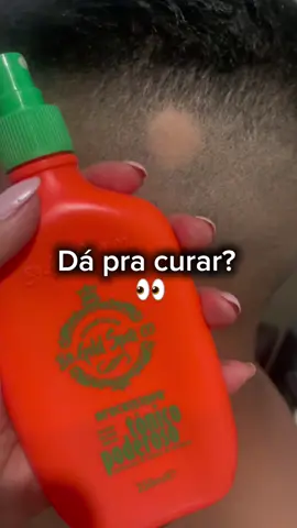 O tônico que salvou o cabelo do meu esposo! 😱💥  Ele estava com alopecia, mas com paciência, persistência e esse tônico poderoso, vencemos! 💪✨ Não foi da noite pro dia, mas os resultados vieram! 💆‍♂️✨ RESULTADO REAL  #gooldspellcosmeticos #everkcosmeticos #tonicopoderoso #lisoetico #fy 