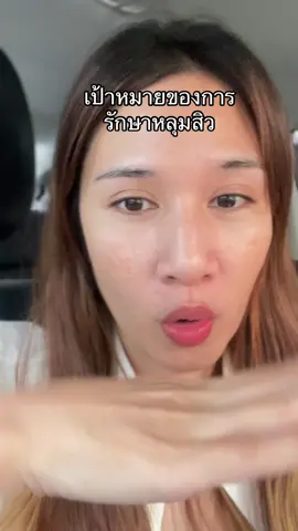 ทำไมถึงเลือกรักษาหลุมสิว ยอมจ่ายเงินหลายหลัก ยอมเจ็บ ยอมอดทด 