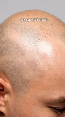 a new spray for hair growth curly hair growth. #trend #satisfyinghairvideos #asmrsounds #trending #fyp 