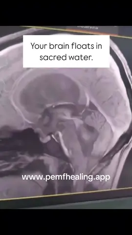 💧🧠 Did you know your brain floats in sacred water? It’s called CSF — cerebrospinal fluid — and your breath is the pump that keeps this living ocean moving. Every inhale and exhale creates a tide, circulating nutrients, cleansing the nervous system, and awakening higher states of clarity. When you breathe with intention, you’re not just bringing in oxygen… you’re moving the waters of consciousness itself. ✨ Breathe deeply. ✨ Move your sacred waters. ✨ Awaken the mind within. #SacredBreath #BrainFlow #CSF #Consciousness #SacredWater  