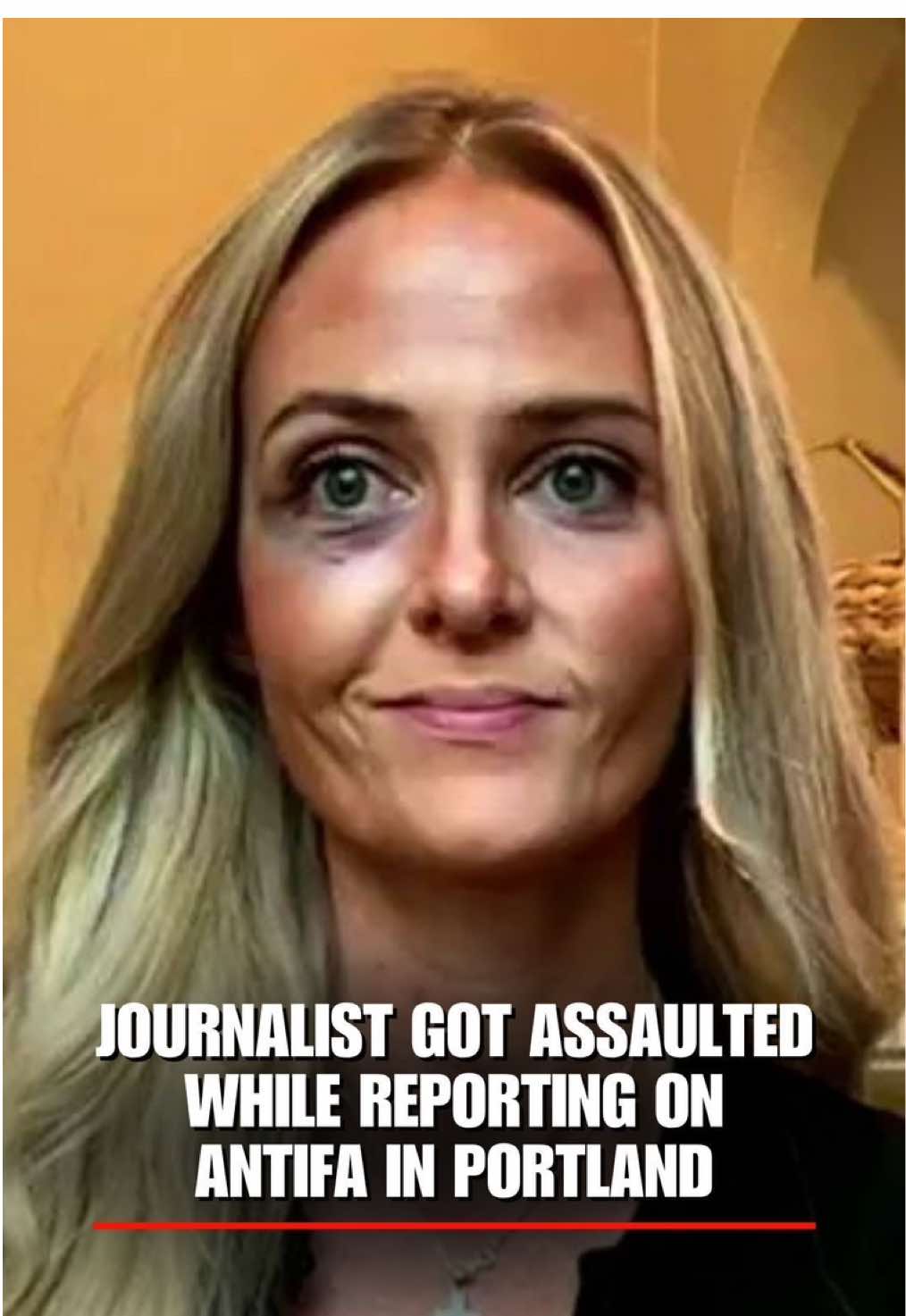 'COMPLETE LAWLESSNESS': Journalist Katie Daviscourt got a black eye while reporting on Antifa taking over city blocks in Portland — and says police refused to arrest the suspect.