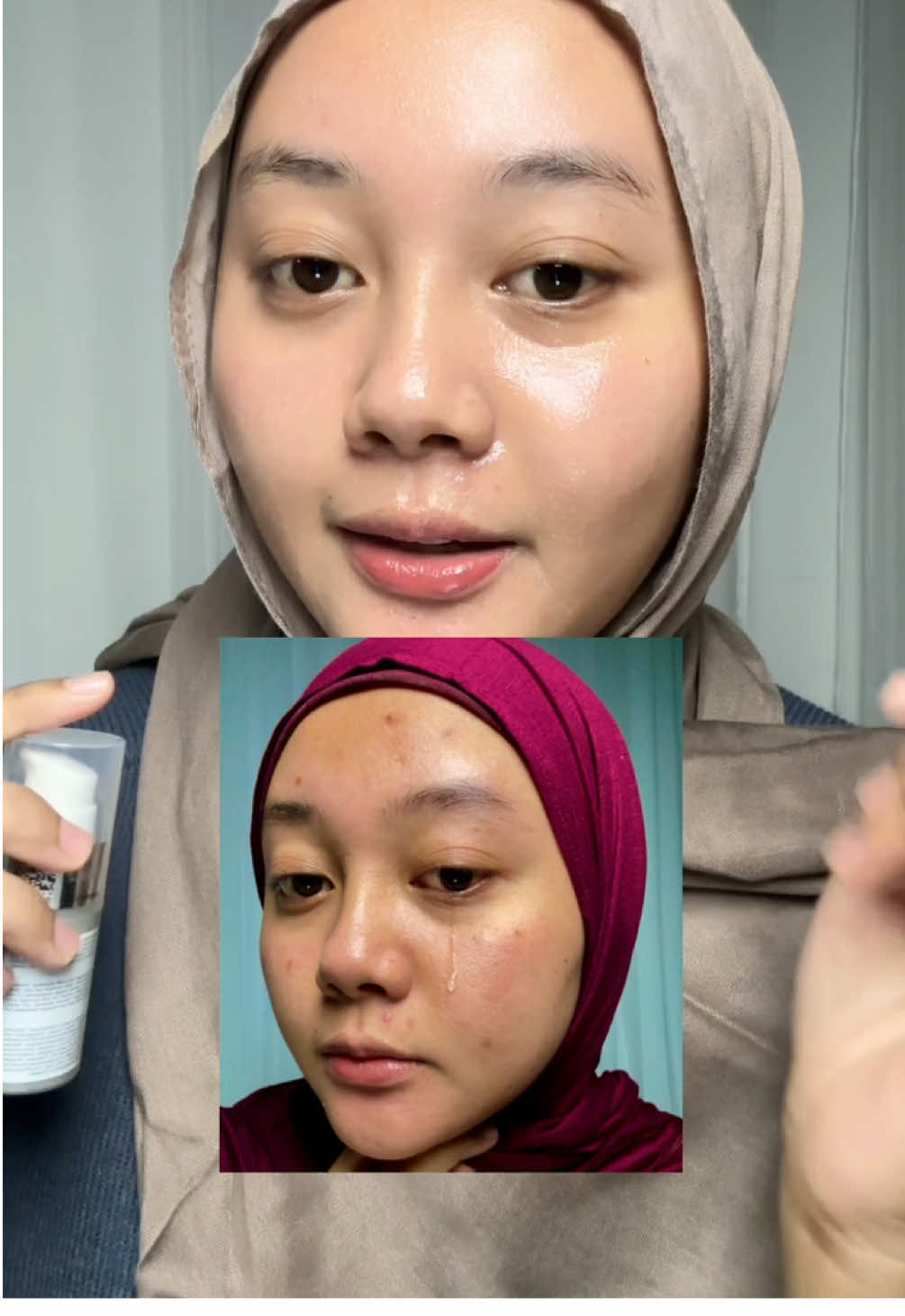 Semakin kuning semakin paten, yapssss bner bgt😍💕 @msglow.beauty  #msglowbeauty #retiglow #dualretiglowroyalelixir 