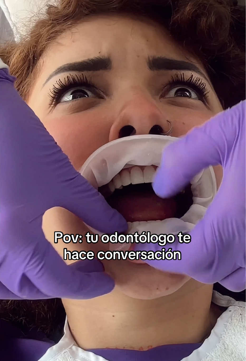 Ellos hablan normal y uno ahí ahogándose🤣 #humor #dentista #odontologia #dientes 