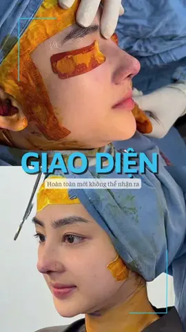 Sau 1 tiếng update luôn giao diện mới #clineclinic #thammy #lamdep #nangmui 