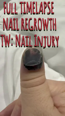 Full Timelapse Nail Regrowth #nails #regrowth #nailtrauma