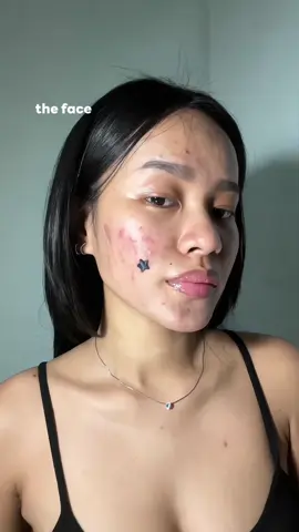 as an acne prone gorlyyyy,  BAKIT NOW LANG KITA TINRY?!!😭  #acneproneskin #fullcoverage #fyp #makeuptok 
