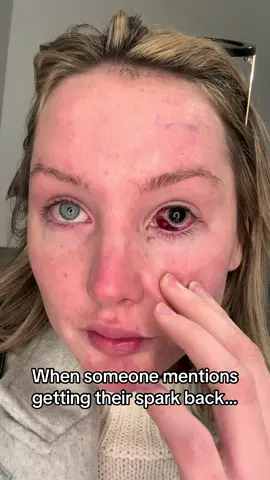 Sorry I went MIA 🥹 #blind #VisionRecovery #EyeSurgery #CataractSurgery #Retina   