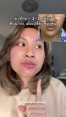 ปากเปลี่ยน = หน้าสดรอด จบ #ลิปเซรั่ม #ลิปpixie #pixielips 