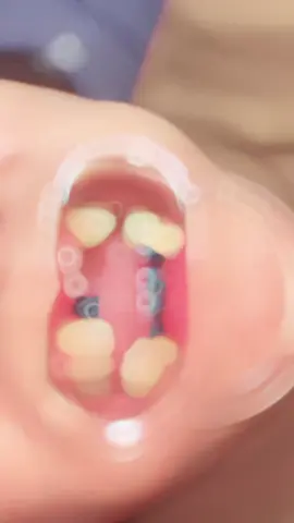 gasken #behelgigi #maduraviral #pamekasanmadura #pamekasan 