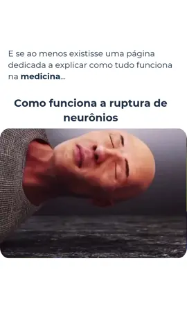 ❓Como funciona a ruptura axonal difusa? ➡️ Ela acontece quando o cérebro sofre uma desaceleração brusca 🚗💥🧠. As forças de cisalhamento “esticam” e rompem os axônios, espalhados pela substância branca. Isso interrompe a comunicação entre neurônios ⚡️ e pode causar coma imediato 😴, mesmo sem grandes sangramentos visíveis nos exames. Nos siga (@comofunciona.med) para aprender como as coisas funcionam na medicina📍 #TraumaCraniano #Neurociência #Coma #TCEM #ComoFunciona