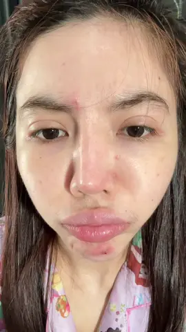 #วดีสกินแคร์ 