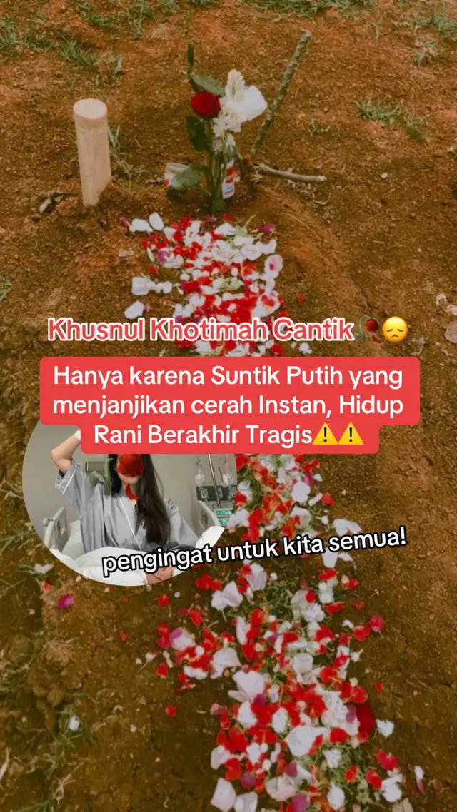 Namanya Rani. Dia Adalah gadis yang memiliki kulit kusam. Tidak sedikit juga yang sering mengomentari kulit rani dekil dan kusam. Dari dulu dia pengen punya kulit cerah. Waktu lihat ada iklan suntik putih yang katanya bisa bikin putih instan, dia langsung tergoda. Karena harganya yang mahal, Dia Ngumpulin uang sampe bisa buat suntik putih.  Setelah tindakan pertama, Rani senang karena kulitnya mulai keliatan cerah. Setelah melihat hasilnya dia tertarik untuk melakukan tindakan suntik putih kedua dengan dosis yang lebih tinggi, lagi dan lagi hasilnya selalu memuaskan dia mendapat pujian banyak orang, tapi siapa sangka, di balik itu ada racun masuk ketubuhnya Beberapa bulan kemudian, muncul bercak merah di kulitnya. Rani pikir cuma iritasi biasa. Lama-lama bercak itu berubah jadi luka yang nggak kunjung sembuh. Setelah diperiksa, dokter bilang: Rani kena kanker kulit akibat paparan bahan kimia yang masuk ke tubuhnya. Dia dan keluarga nggak menyerah. Berobat, terapi, operasi—semuanya dijalanin dengan harapan bisa sembuh. Ada saat di mana keluarga merasa lega, karena kondisi Rani sempat membaik. Tapi sayangnya, racun itu sudah terlalu lama bersarang. Perlahan, sakitnya makin parah. Sampai akhirnya, Rani harus menyerah dan pergi untuk selamanya Sedih masih terasa dalam keluarga nya!  Guys, Cantik itu butuh proses, bukan hasil instan. Jangan pernah gampang tergoda sama produk yang janjiin “putih cepat” tapi nggak jelas kandungannya. Kadang, hasil kilat dibayar dengan kesehatan—bahkan nyawa. Jaga diri, cintai kulitmu dengan cara yang aman. Karena sehat jauh lebih berharga daripada sekadar terlihat cerah sesaat. #meninggal #beritaviral #cerita #4u #suntikputih 