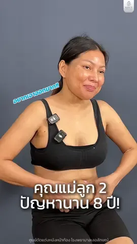 คุณแม่ลูก 2 ปัญหานาน 8 ปีตัดสินใจตัดหนังหน้าท้องคือทางออก✂️✨#เทรนด์วันนี้ #คุณหมอโบนัส #รีวิวตัดหนังหน้าท้อง #โรงพยาบาลเลอลักษณ์ #โรงพยาบาลเลอลักษณ์ศัลยกรรมเสริมความงาม 