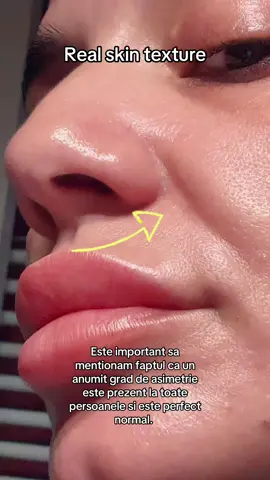 #neantrenam #ceziceri? #textureskin #asimetricalface 
