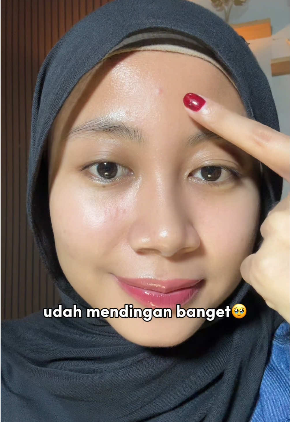 untung gapernah capek ngadepin muka yang sering muncul jerawat ini, karna selalu pakai acne spot dari #YOU 😍