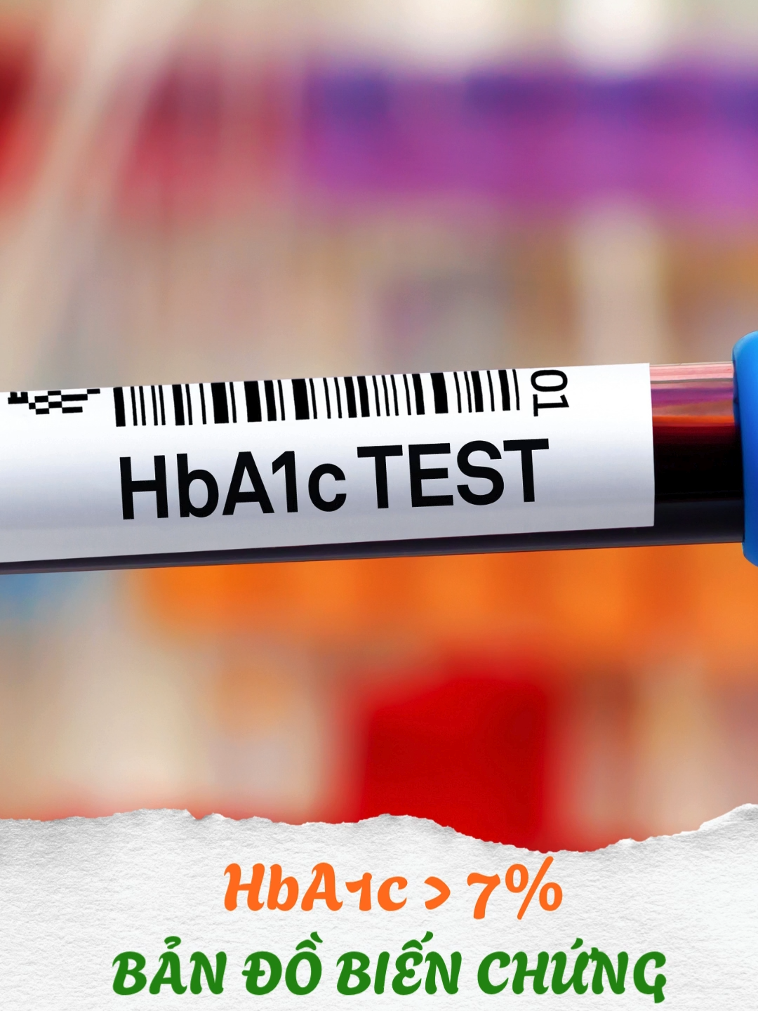 HbA1c > 7mmo/L bản đồ biến chứng tiểu đường đã mở! #glutex #tieuduong #daithaoduong #suckhoe #songkhoe #tuyp2