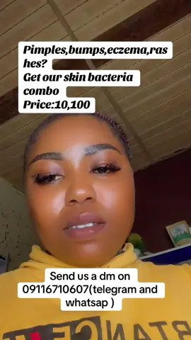 For pimples,acne,bumps,rashes,psoriasis etc get this combo  Price:10100 Send us a dm on 09116710607 to place order  #acnetreatment #facialwash #ibadanskincare #goviral #lizoherbalsandskincare 