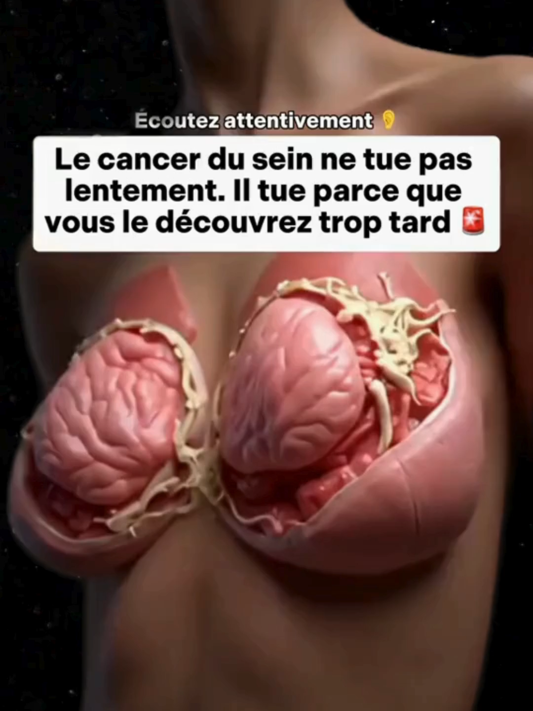 Beaucoup de femmes meurent du cancer du sein, non pas parce que la médecine est impuissante… 😨 #shilajit #nourriture #france #fyp #santé