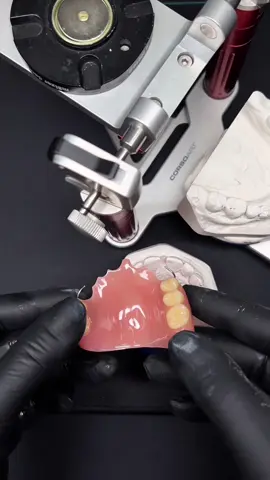 #creatorsearchinsights #dentaltechnician #dentallaboratory #Dentures #dentaltiktok  Teeth, Smile, Prosthetic 